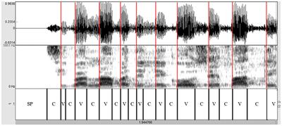 Speech Rhythm Variation in Early-Stage Parkinson's Disease: A Study on Different Speaking Tasks